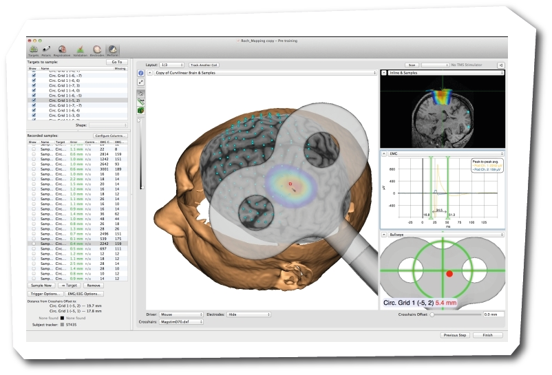 Brainsight TMS Navigation | Brainbox